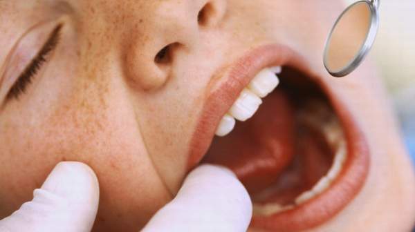 Persistent patches or other changes in your mouth need a dentist's evaluation.